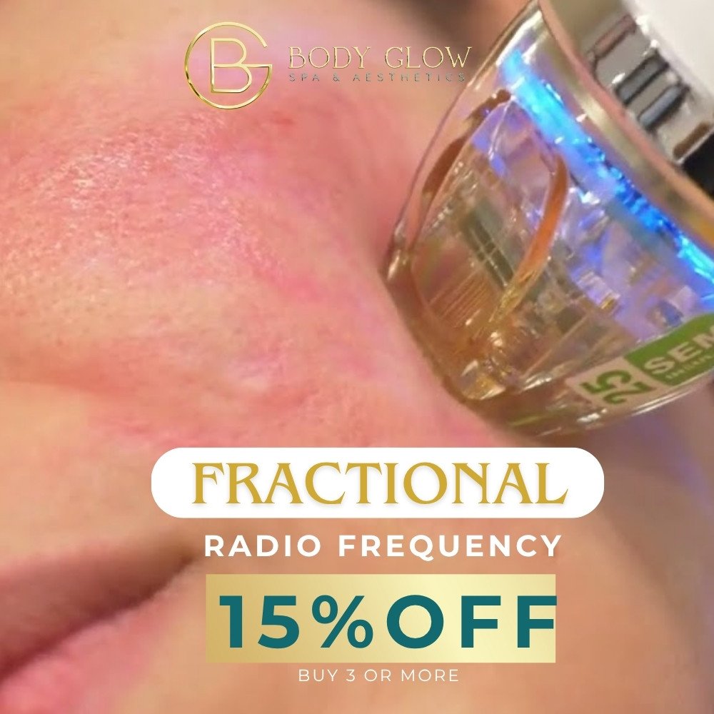 Venus Viva Radiofrequency