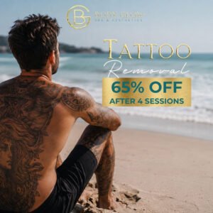 Tattoo Removal