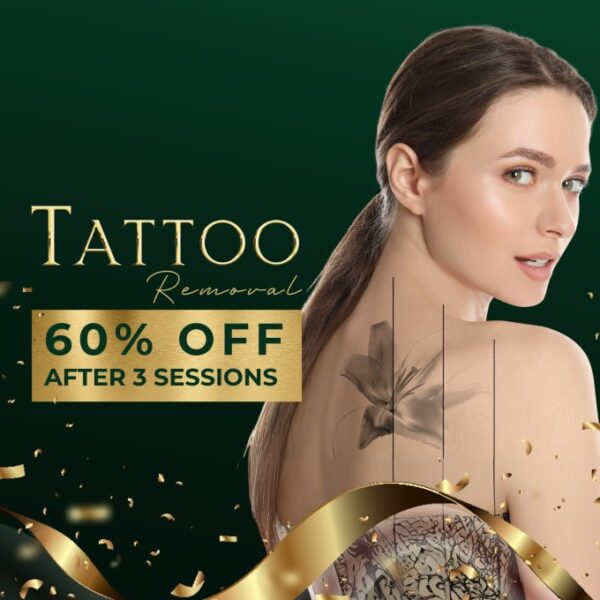 Tattoo Removal - Blackfriday Sale