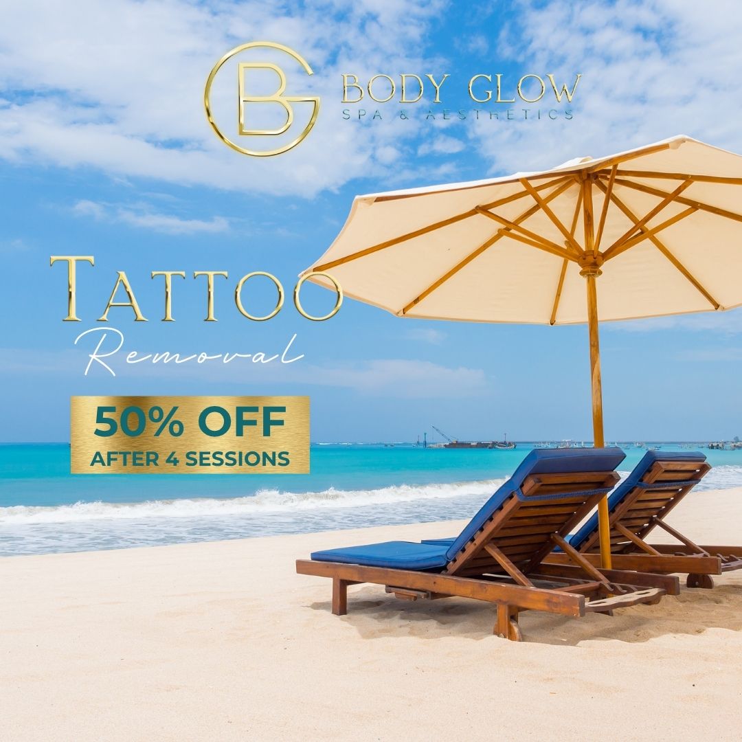 Tattoo Removal