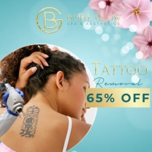 Tatoo Removal - Spa Spring Sale