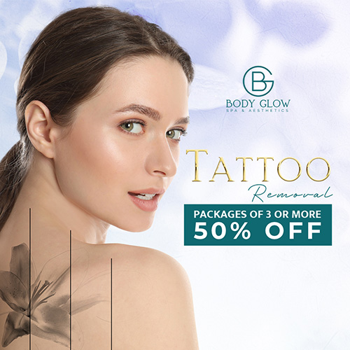 Tattoo Removal Mothers day sale