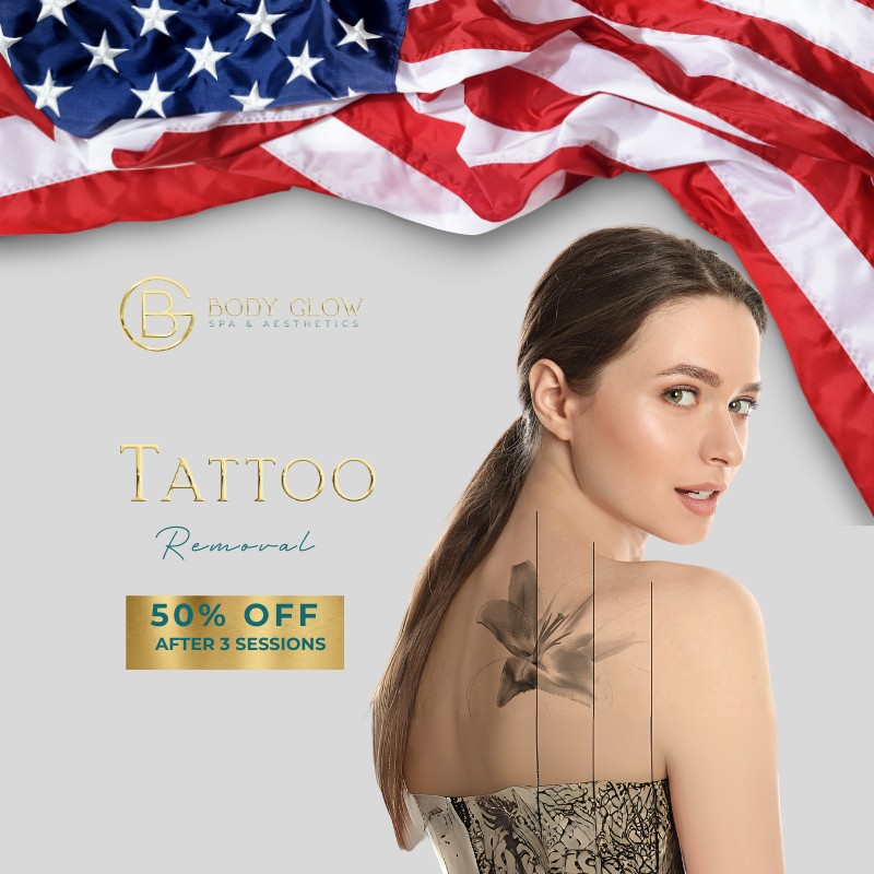 Tattoo Removal - Memorial Day Sale