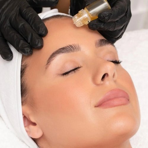 AquaGold® Facial Queens 2