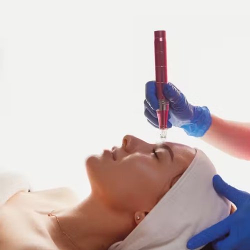 Exosome Microneedling Queens